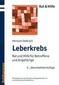 Leberkrebs